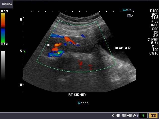 pelvic sonogram pelvic sonogram