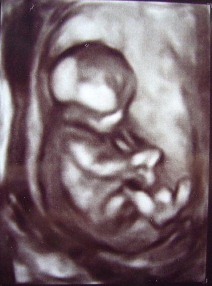 Baby Davy: a 3D ultrasound of our baby at only 12 weeks!  Technology is amazing...
