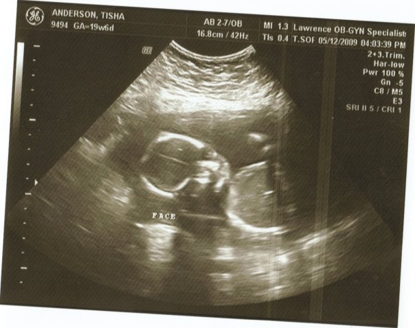 [n82406166_32564496_8308747.jpg]