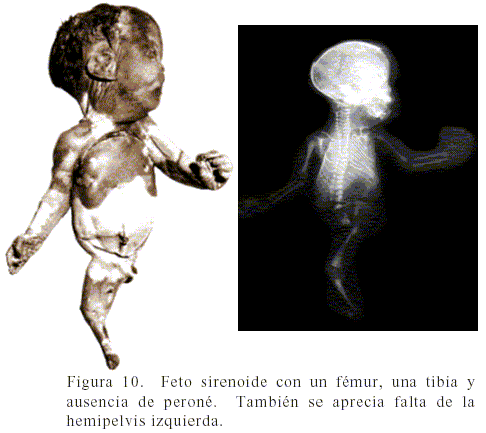 [teratismo+ectrogenico.gif]