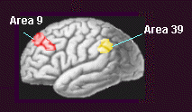 brain-area.gif