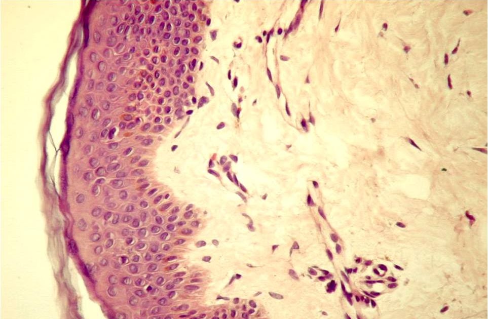 medicamente de histologie a țesutului conjunctiv