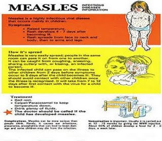 Measles cure and prevention
