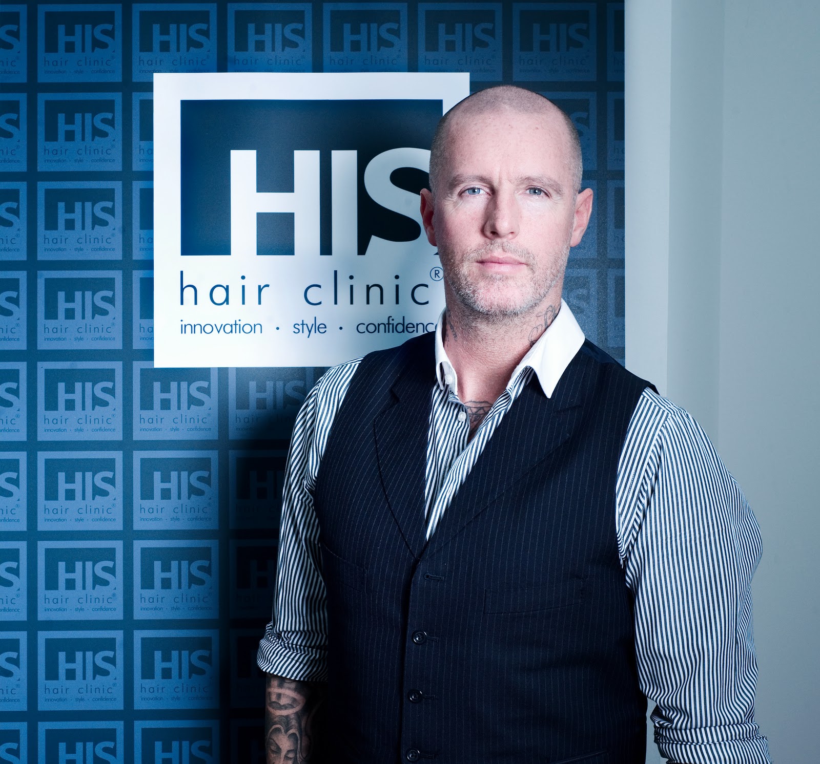 Furorestyle HIS Hair Clinic's "amazing" solution to male hair loss