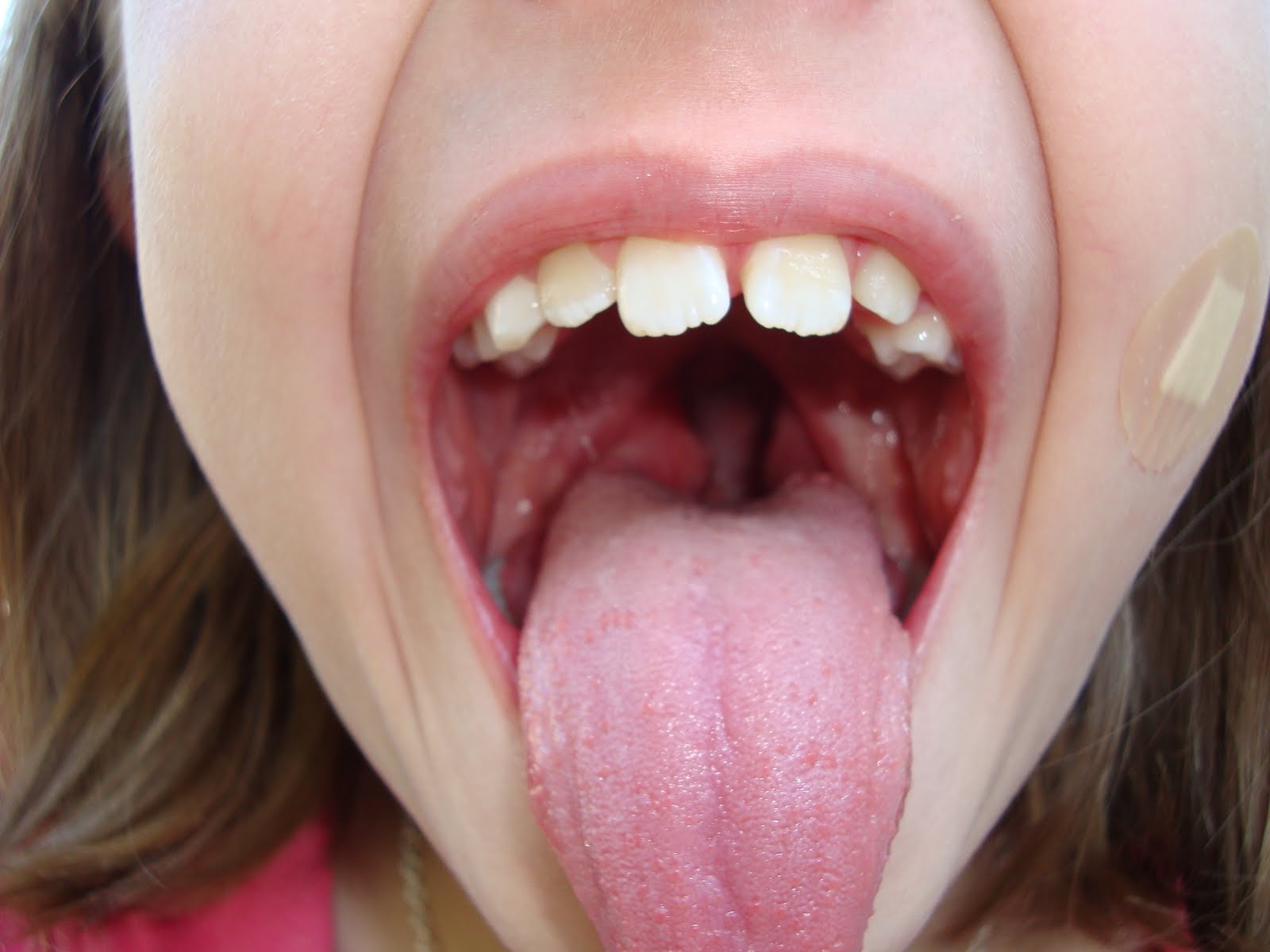 momma-drama-good-bye-tonsils
