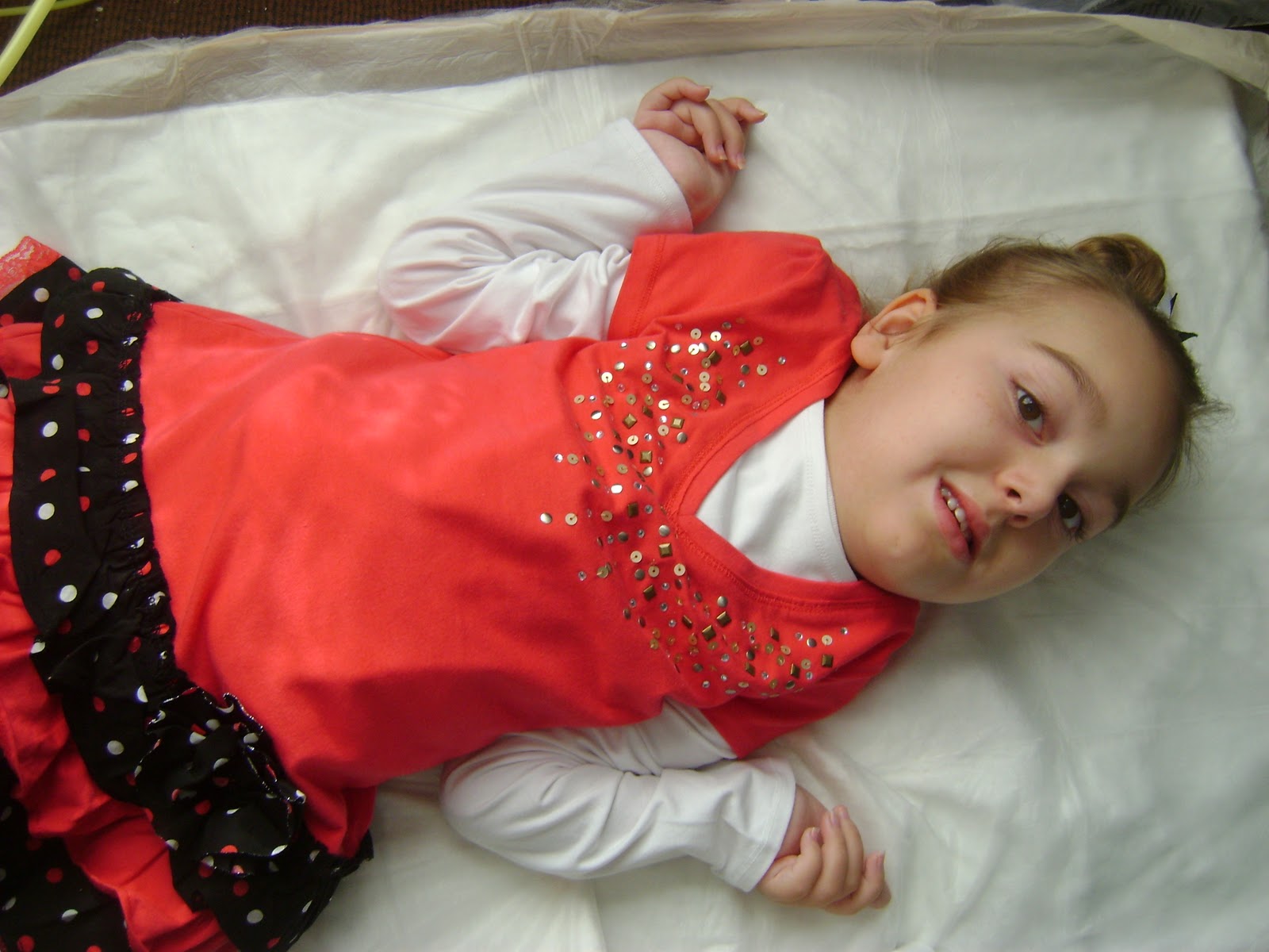 болезнь сма что это