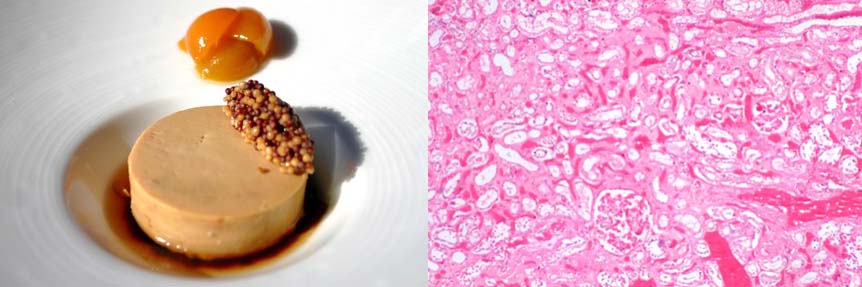 [foiegras_mustardseed_amyloidosis.jpg]