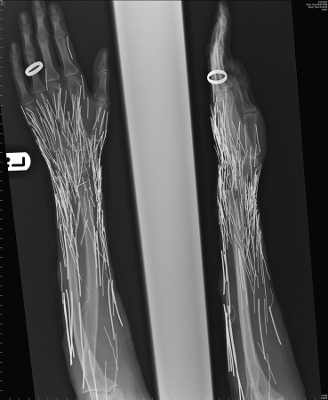 [Figure+2+-+embedded.jpg]