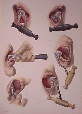 Você tem medo de ir ao dentista?
