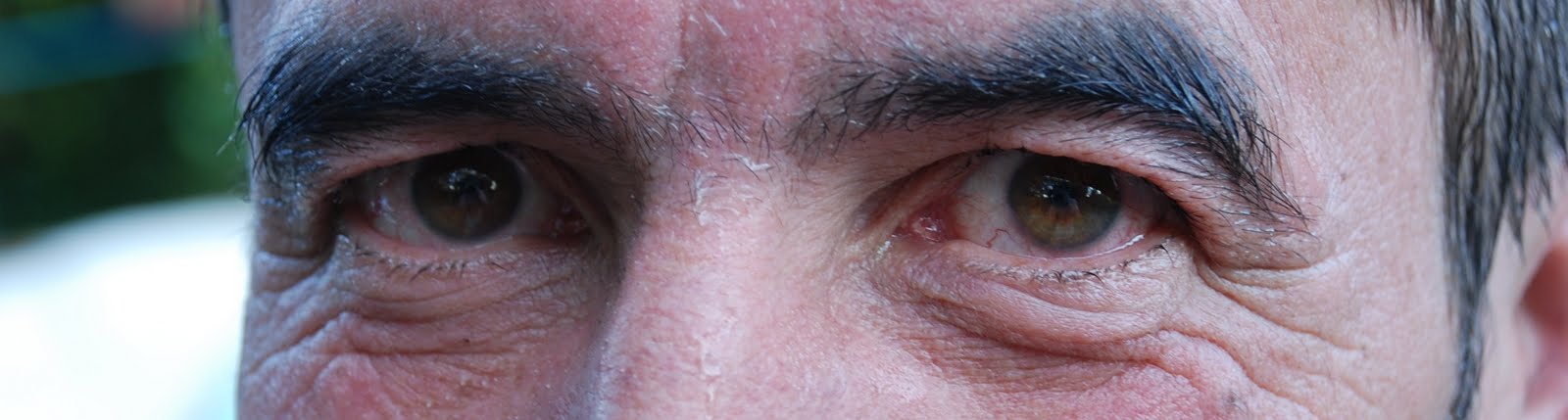 [Eyes_2.jpg]