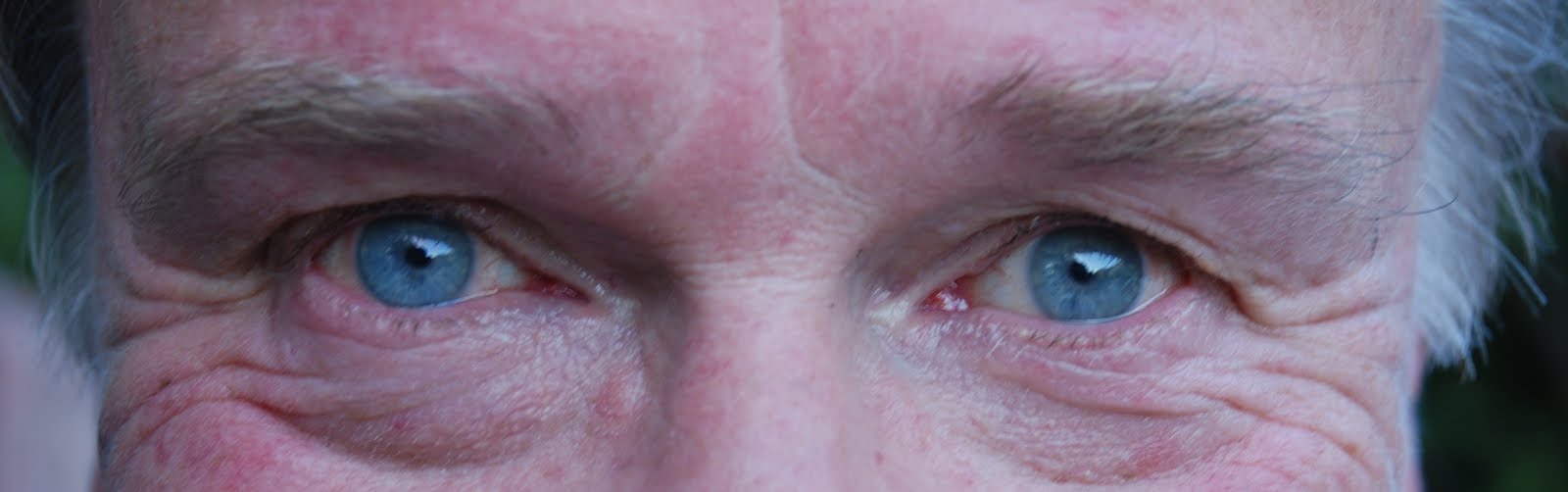 [Eyes_1.jpg]