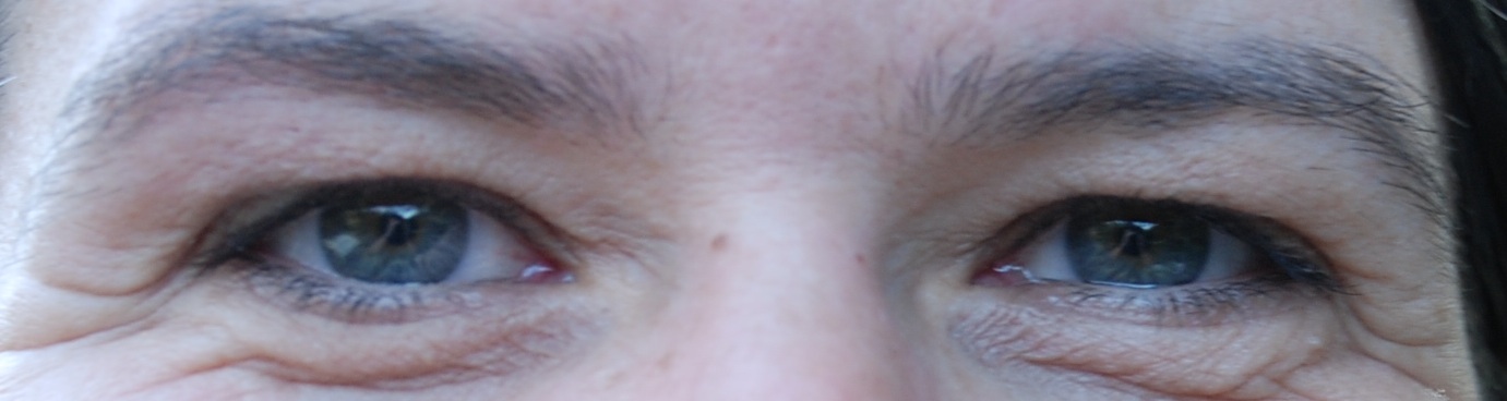 [Eyes_7.jpg]