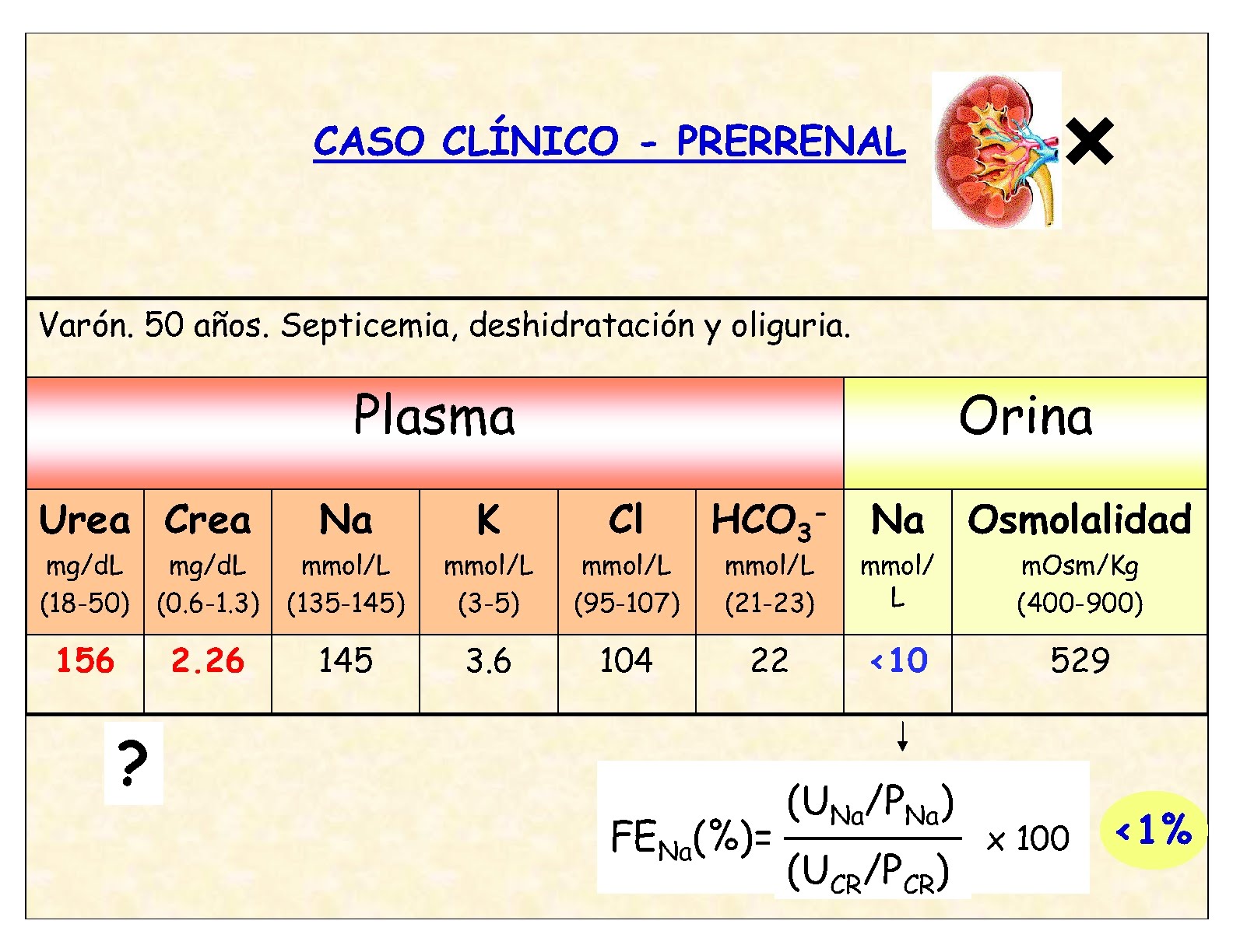 Laboratorio deTerapia Intensiva: insuficiencia renal aguda