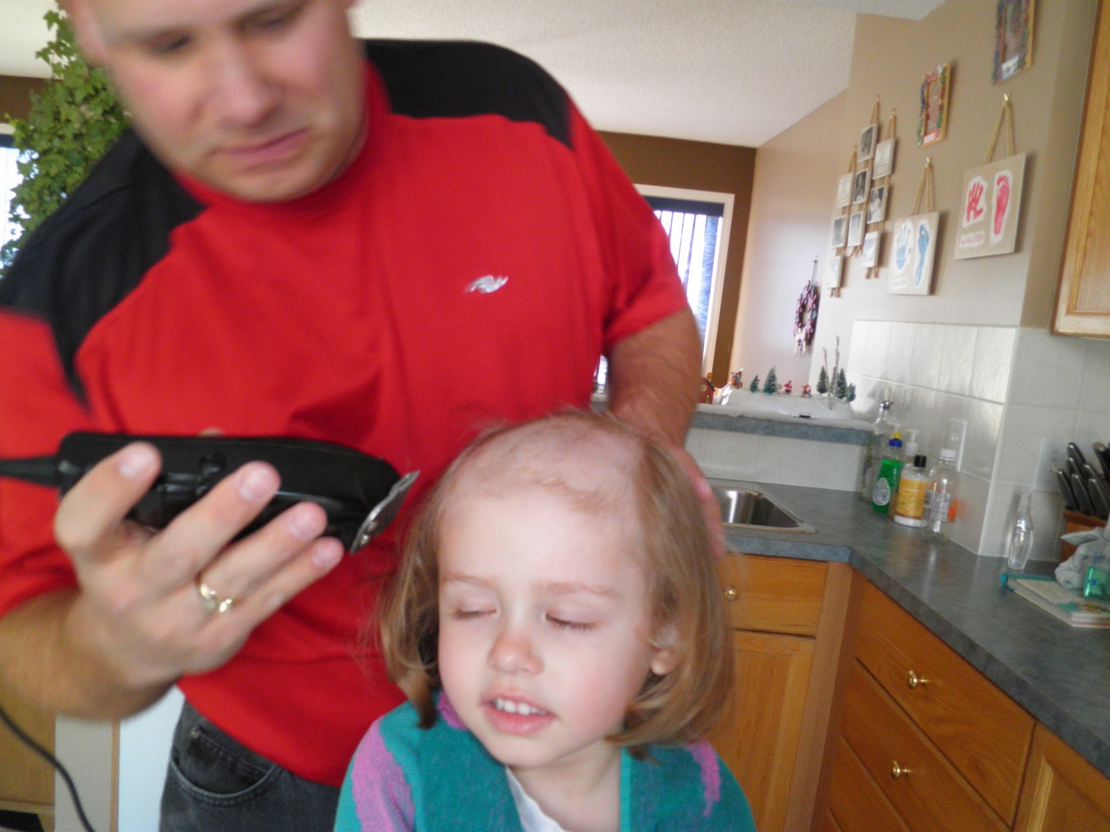 Karlee s Leukemia Journey Hair Loss