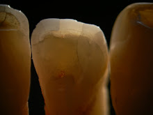Denti Naturali