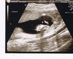 Baby Foot   -04/16/2009