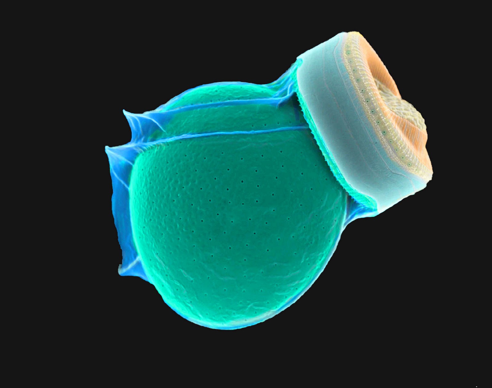 диатомовые водоросли. диатомовые водоросли под микроскопом. диатомовые водоросли микроскоп. диатомовые водоросли микроскоп. диатомовые водоросли.