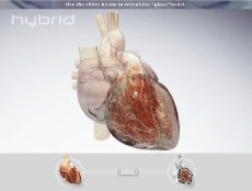 http://1.bp.blogspot.com/_KQHRSAxoe64/SPU7iTpgAjI/AAAAAAAAA9U/9LPjbWq2Lug/s320/Hybrid+Medical+Animation+%7C+Animation+%7C+Interactive+Heart_1224030364196.jpeg