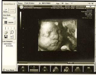 Our Baby Clark...: Week 33 High-Risk Ultrasound