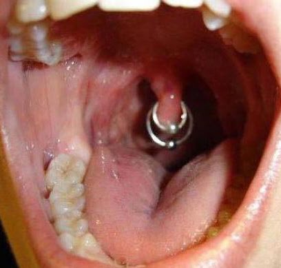 Piercing Oral na Adolescência
