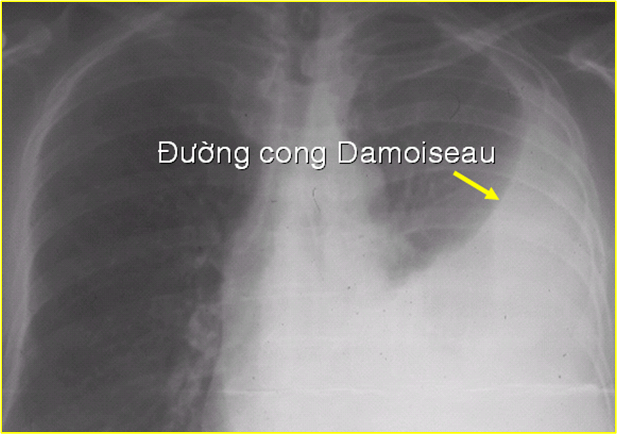 K36B-YTB : LUÔN LUÔN LẮNG NGHE - LUÔN LUÔN THẤU HIỂU: Một số điều nên biết