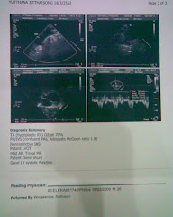 ผลตรวจ Echo report page 2