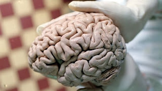 Científicos hallaron neuronas “Facebook” en el cerebro