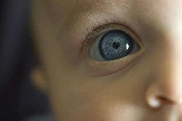 [bebeklerde+şaşılık.jpg]