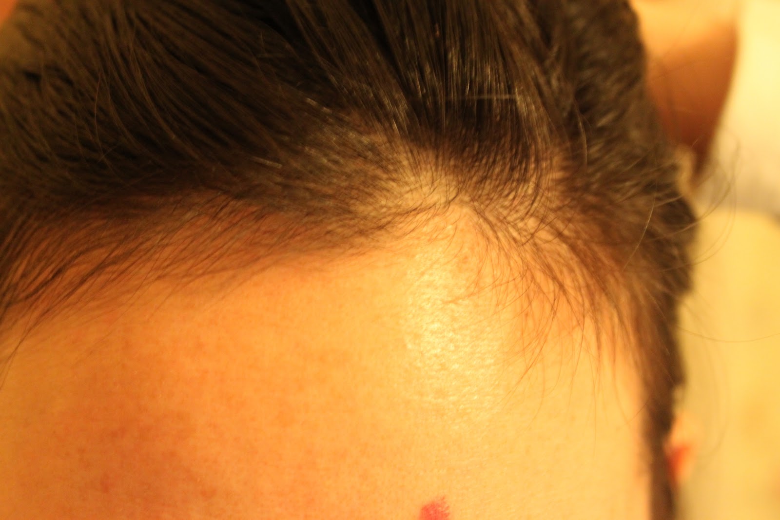 JennOveeV Postpartum Hair Loss