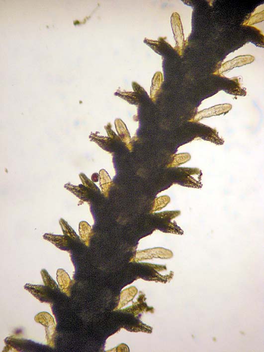 Beyond the Human Eye Brittle Stars