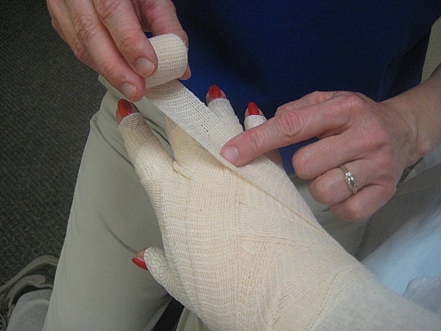 On The Road Again - well, not really: Lymphedema - here we go again