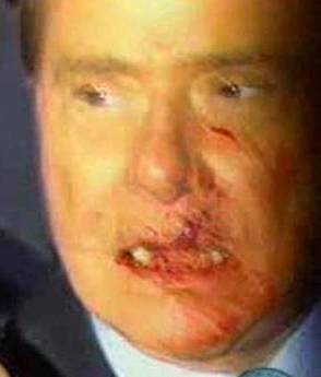 [berlusconi+ferito.jpg]