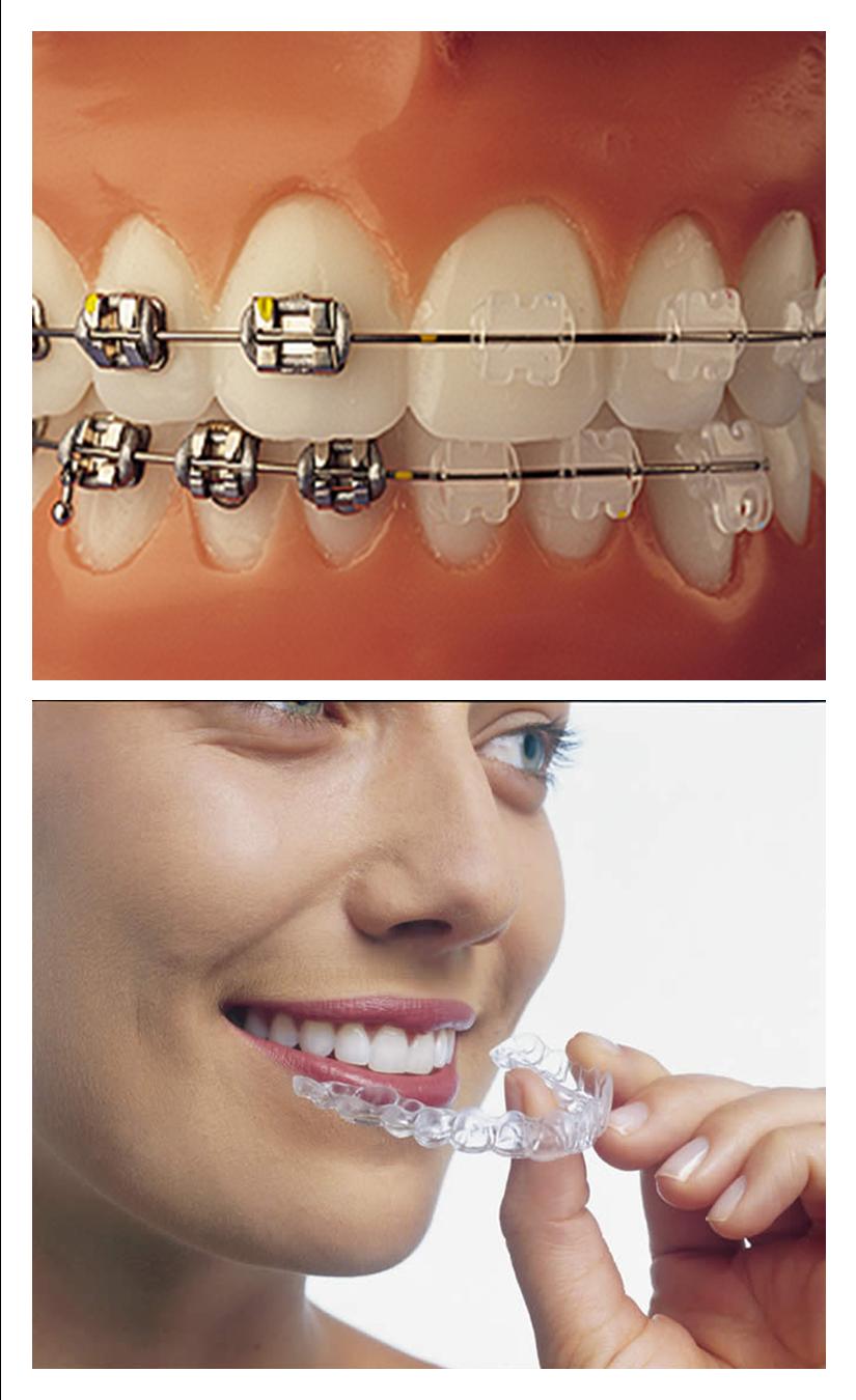 Orthodontist Melbourne Launceston Dentist The Cost of Braces