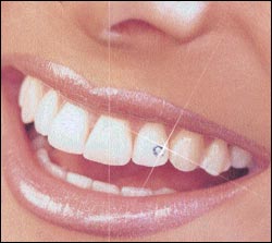 [2009-05-fn-tooth-decoration-teeth.jpg]