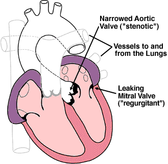 [valvular.gif]
