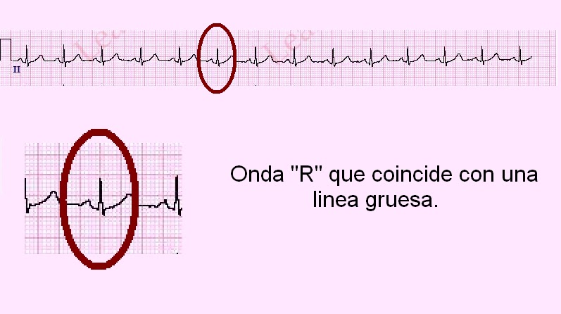 I'm a nurse boy aspiring to... [no idea]: Electrocardiografía - ¿Cómo ...