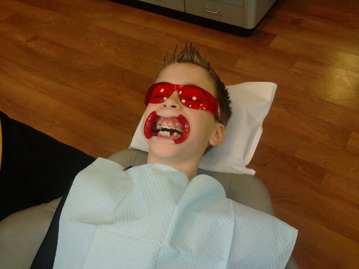 Hogg Party of Four Tanner Getting Bottom Braces