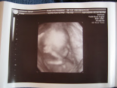 Here's our newest "Little Lemmon"