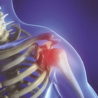 Info Med & Salud: Todo lo que necesitas saber!: Bursitis
