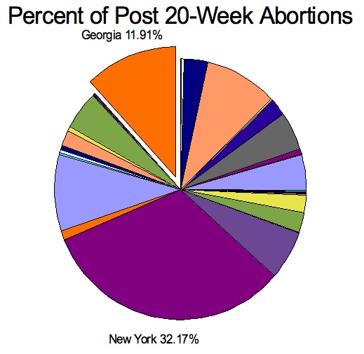 [Abortions+Past+20+Weeks.jpg]