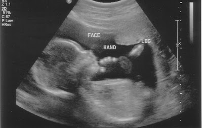 The Next Generation