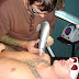 Laser Treatment Tattoo Removal-No Scar & No Pain