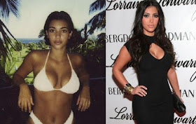 kim kardashian plastic surgery