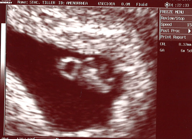 Ultrasound 1