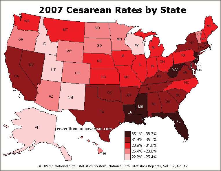 Процент кесарево. Кесарево сечение статистика в мире. Воз кесарево сечение статистика. Процент кесарева сечения в США 2020. Процент кесарева сечения в мире.