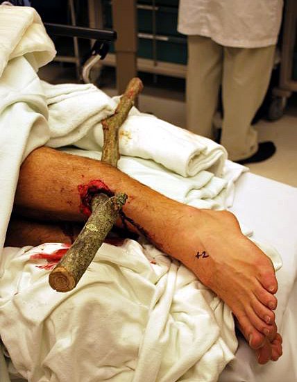 [bike+accident.jpg]
