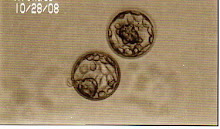 2 Embryos Pre-Transfer