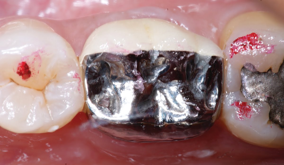 Benco Dental We deliver success smile after smile. Hints From Howard