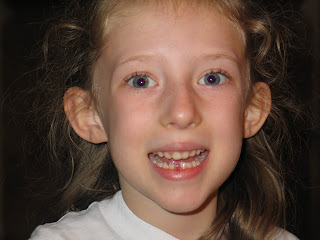 Mandi loses her first tooth!