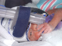 [2004.08.27EdenCPAPWithPacifier.jpg]